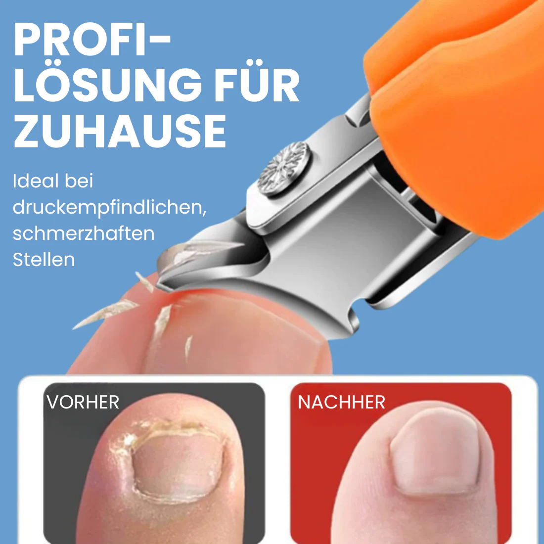 NAGELHELD - Nagelknipser für eingewachsene Nägel - Image 2